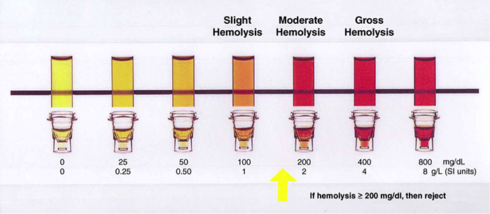Coagulation Hemolysis Chart